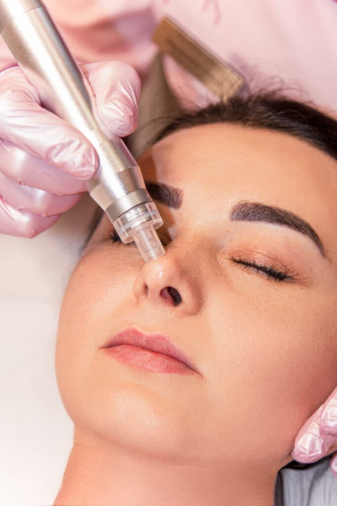 Micro-aiguillage visage : soin hydratant sur le nez Esthéticienne avec gants roses appliquant un traitement de micro-aiguillage sur le nez d'une cliente aux yeux fermés.